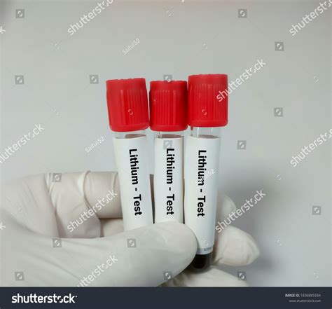 187 Lithium Start Images, Stock Photos & Vectors | Shutterstock