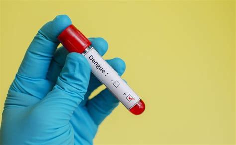 What Are Some Telling Signs Of Dengue? And Here’s How You Can Shield ...