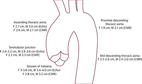 Thoracic Aortic Aneurysm and Dissection | JACC