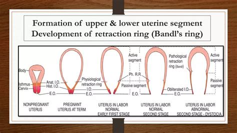 First stage of labor | PPTX