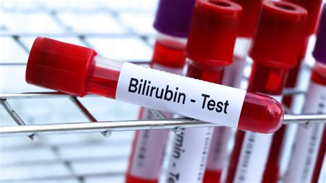 Total & Direct Bilirubin Test | Liver & Blood Health Check 🟡