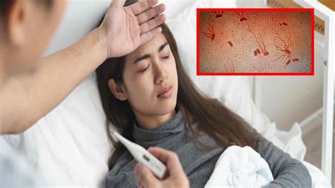 Typhoid Fever : టైఫాడ్ జ్వరమా! ఈ లక్షణాలుంటే జాగ్రత్త పడాల్సిందే ...