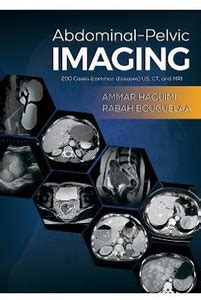 Abdominal-Pelvic Imaging: Buy Abdominal-Pelvic Imaging by Haouimi Ammar ...