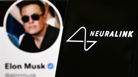 Neuralink: Elon Musk gets green light to study brain implant in humans ...