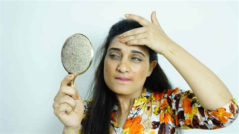 Bumps on Forehead and Face: Why do they happen?