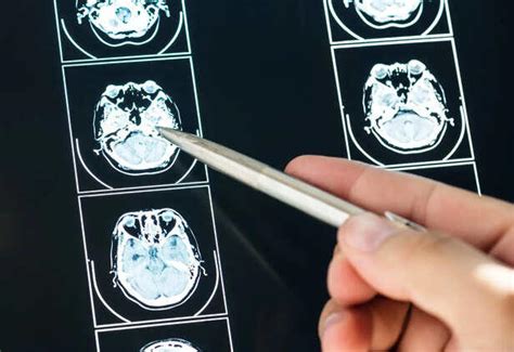 Most extreme injuries humans survived – real cases