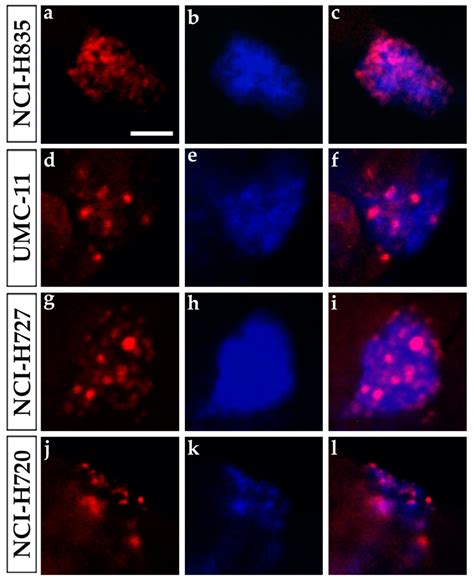 Modeling Lung Carcinoids with Zebrafish Tumor Xenograft