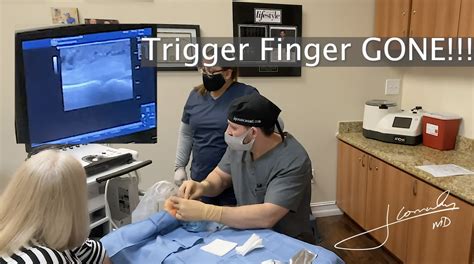 Trigger Finger Release: Trigger Finger Surgery Success Rate – MFTZTR