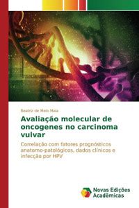 Avaliacao Molecular de Oncogenes No Carcinoma Vulvar: Buy Avaliacao ...