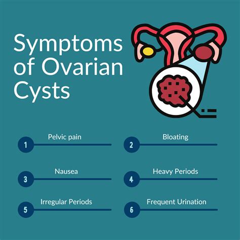 Everything you need to know about ovarian cysts – Artofit