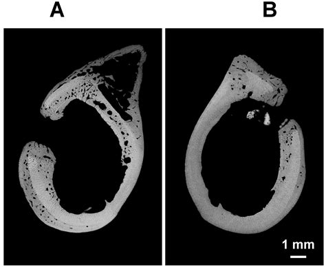 Bone Regeneration by Novel Bioactive Glasses Containing Strontium and ...