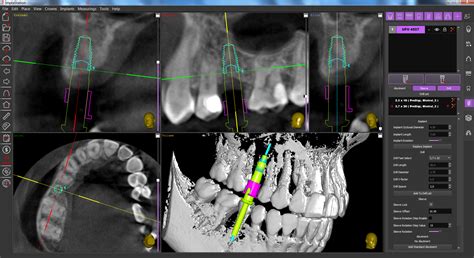 Dentist Guildford | Digital Dentistry: CBCT SCAN