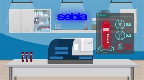 Image result for Sebia Reagent