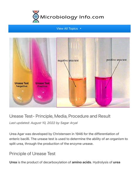 Urease Test - Principle, Media, Procedure and Result | PDF | Clinical Medicine | Medical Specialties