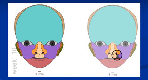 Embryonic Facial Development 的图像结果