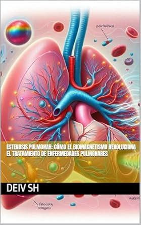 Estenosis Pulmonar: Cómo el Biomagnetismo Revoluciona el Tratamiento de ...