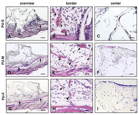 Recent Developments in Polyurethane-Based Materials for Bone Tissue ...