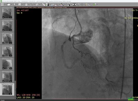 Radiant DICOM Viewer Full Phần mềm đọc file DICOM trên máy tính miễn phí – Y học online