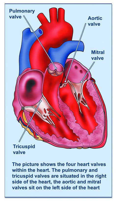 Valve replacement - British Heart Valve Society