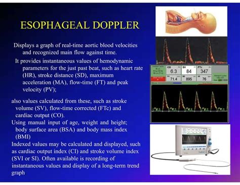 Image result for Testing Cardiac Monitor Output