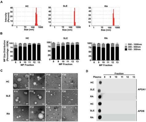 A Novel Pool of Microparticle Cholesterol Is Elevated in Rheumatoid ...