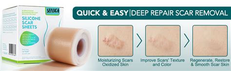 SEFLICA® Scar Removal Tape – Reusable Silicone Scar Sheets for C ...