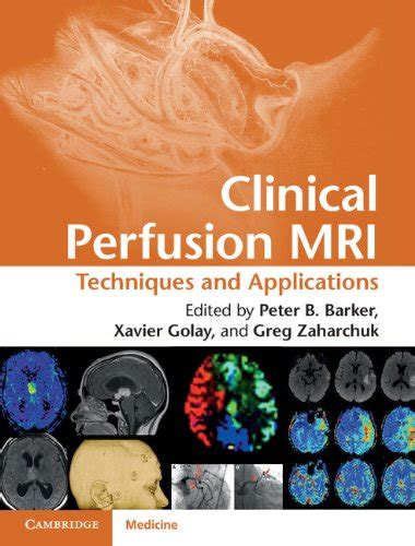 Clinical Perfusion MRI: Techniques and Applications eBook : Barker ...