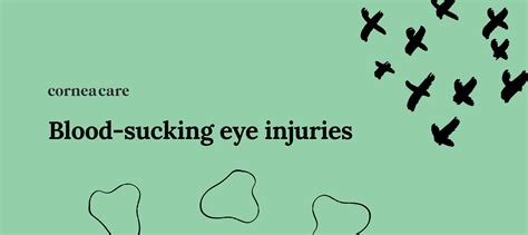 What to Do If You Get a Mosquito Bite on Eyelid - CorneaCare