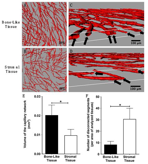 In Vitro Prevascularization of Self-Assembled Human Bone-Like Tissues ...