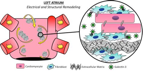 Galectin-3 in Atrial Fibrillation: Mechanisms and Therapeutic Implications