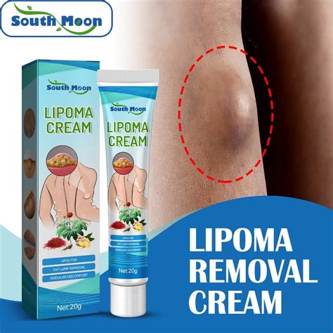 South Moon Lipoma Removal Cream 20g Herbal Formula Relieves Subcutaneous Lumps And Deeply ...