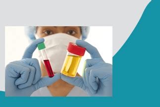 CHLORIDE, 24 HOUR URINE - TrueMedix