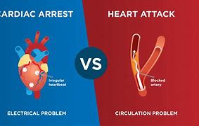 Image result for cardiac arrests