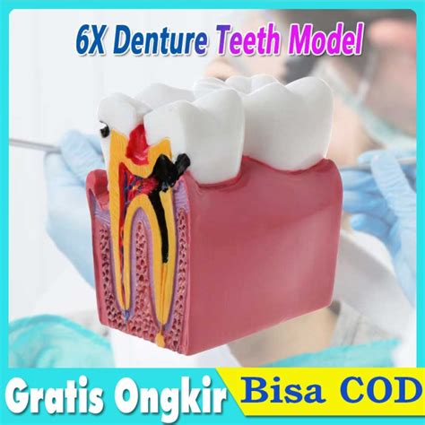 Jual Alfasima 88 Patung Gigi Dental Model Anatomi Gigi 6 Kali Untuk ...