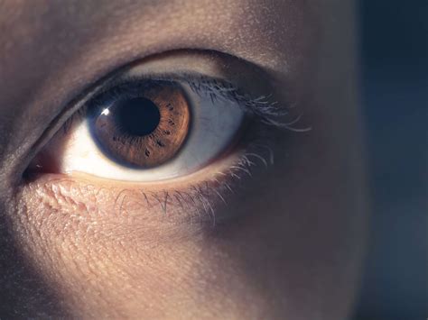 Black Spot In Eye Ball