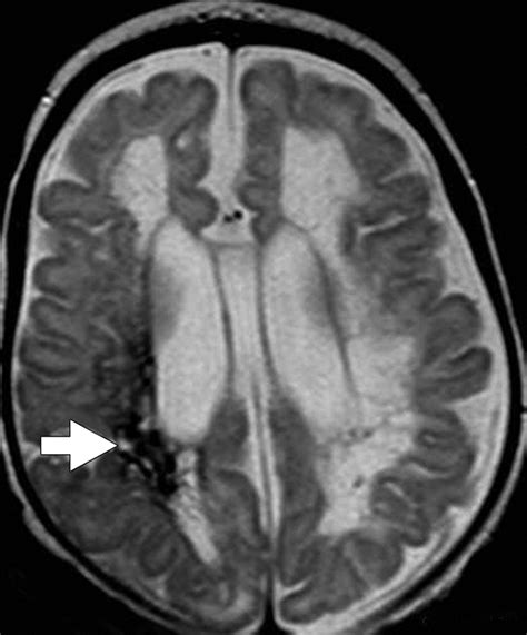 Image result for G0283 Code Example