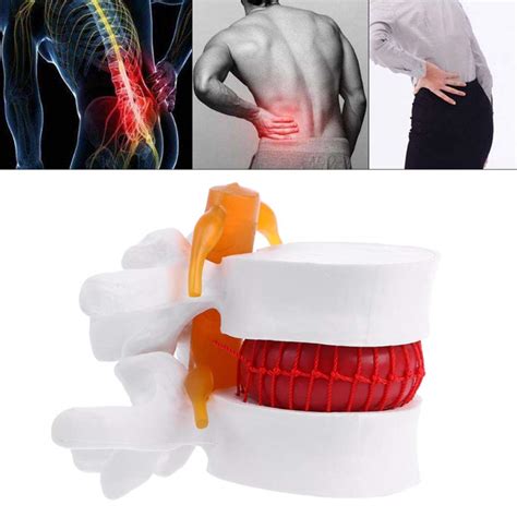 Educational Model Anatomical Model Lumbar Vertebrae Lumbar Spine ...