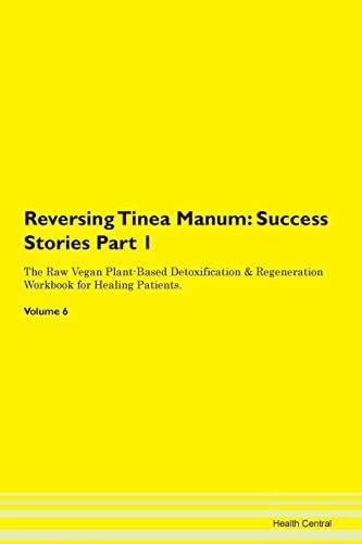 Reversing Tinea Manum: Success Stories P : Central, Health: Amazon.in ...