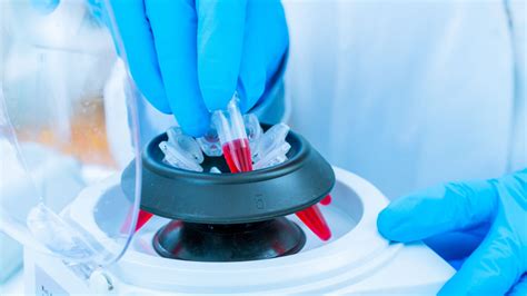 Platelet-Rich Plasma Therapy: How it Works - Ascent Pain Solutions