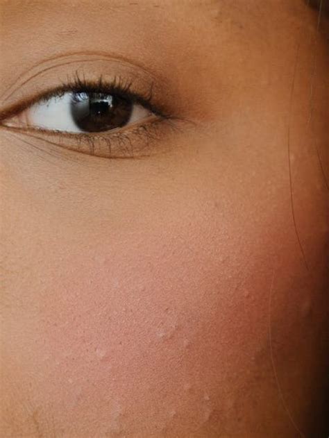 4 Foods That Fight Skin Inflammation