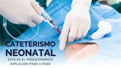 Que Es Un Cateterismo