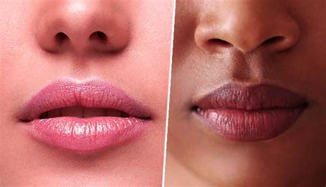 6 Remedies To Get Rid of Dark Lips Naturally at Home - lifeberrys.com