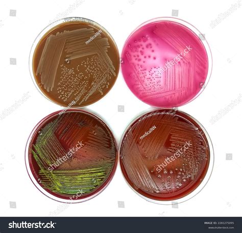 EMB (Eosin Methylene Blue) Agar Plate, Composition And, 40% OFF