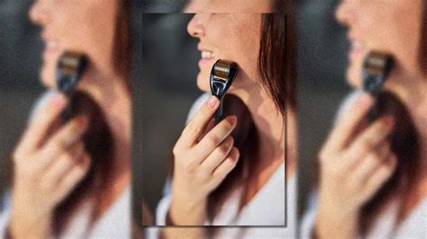 5 Derma Roller Benefits You Should Know For Healthy, Glowing Skin ...