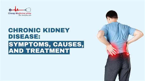 kidney failure stages Archives - Cheapmedicineshop Blog