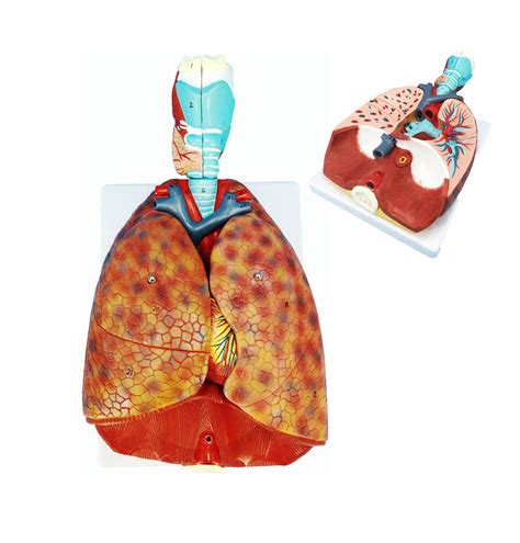 Uigjiog Human Lung And Respiratory System Model Human Lung Model ...