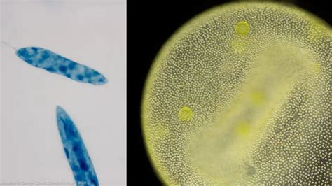 Rhizopus Under Microscope - Biology Notes Online