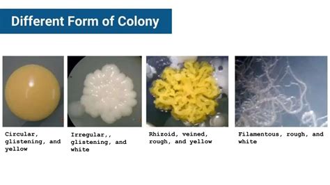 Different types of Bacterial Colony and their characteristics.pptx