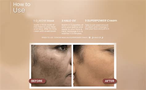 BiE Anti Pigmentation Kit | Treats Pigmentation, Melasma, Dark spots ...