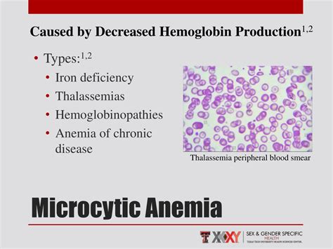 Meaning Of Microcytic Anemia at Gary Delariva blog